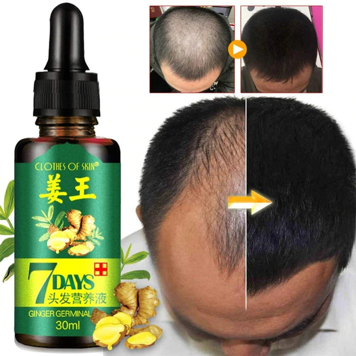 7 Day Ginger Germinal Oil Hair Nutrient Solution Hair Growth