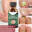 Fast Nail Fungal Treatments Nail Repair Essences Serum Care